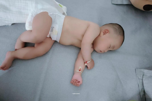 来宾六个月宝宝眼睛散光